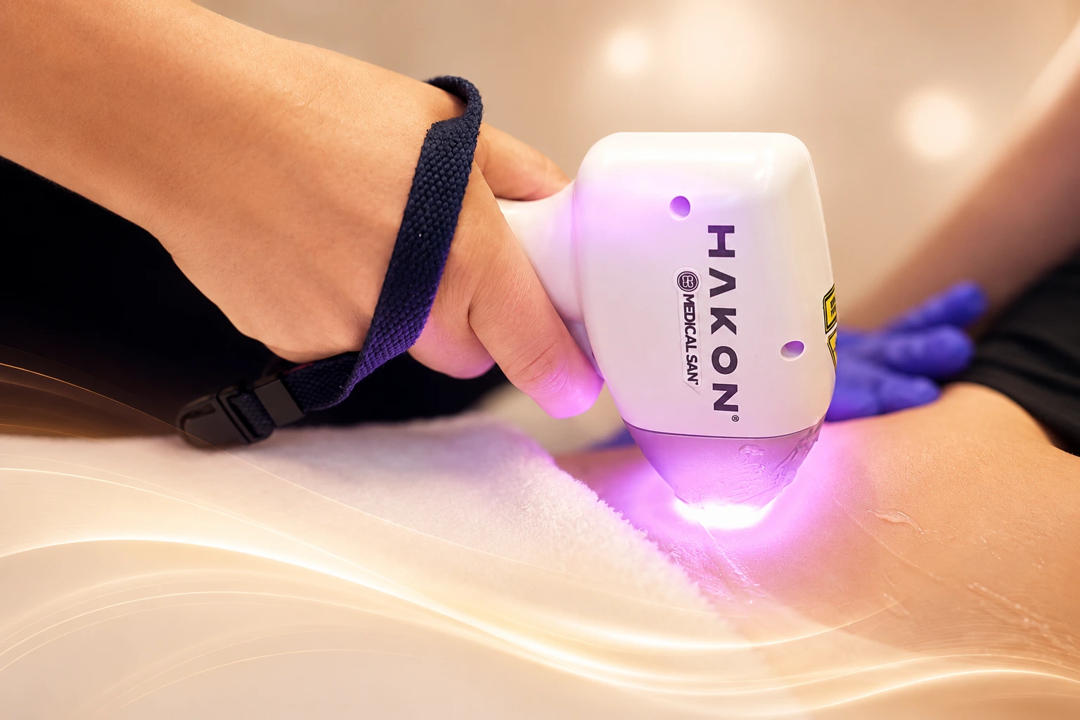 Sessão de depilação a laser com atendimento personalizado na Baumi Clínica em Cascavel.